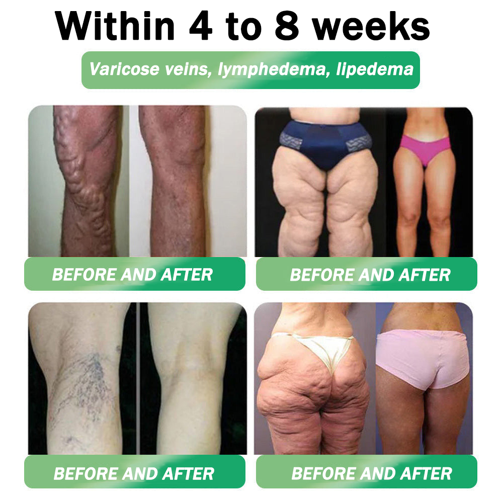 🇺🇸𝑶𝒇𝒇𝒊𝒄𝒊𝒂𝒍 𝑺𝒕𝒐𝒓𝒆|👨‍⚕️👨‍⚕️HH𝐕𝐁® 𝐍𝐀𝐃+ 𝐆𝐋𝐏-𝟏 Pro ALL-IN-ONE Fit&Vital 𝐎𝐫𝐚𝐥 𝐋𝐢𝐪𝐮𝐢𝐝 (𝐉𝐮𝐬𝐭 𝐨𝐧𝐜𝐞 𝐚 𝐝𝐚𝐲, 𝐯𝐢𝐬𝐢𝐛𝐥𝐞 𝐜𝐡𝐚𝐧𝐠𝐞𝐬 𝐢𝐧 𝟕 𝐝𝐚𝐲𝐬） ✅ 𝐅𝐨𝐫 𝐨𝐛𝐞𝐬𝐢𝐭𝐲, 𝐜𝐚𝐫𝐝𝐢𝐨𝐯𝐚𝐬𝐜𝐮𝐥𝐚𝐫 𝐡𝐞𝐚𝐥𝐭𝐡, 𝐝𝐢𝐚𝐛𝐞𝐭𝐞𝐬, 𝐬𝐥𝐞𝐞𝐩 𝐚𝐩𝐧𝐞𝐚, 𝐆𝐮𝐭 𝐇𝐞𝐚𝐥𝐭𝐡, 𝐣𝐨𝐢𝐧𝐭 𝐢𝐬𝐬𝐮𝐞𝐬, 𝐚𝐧𝐝 𝐦𝐨𝐫𝐞