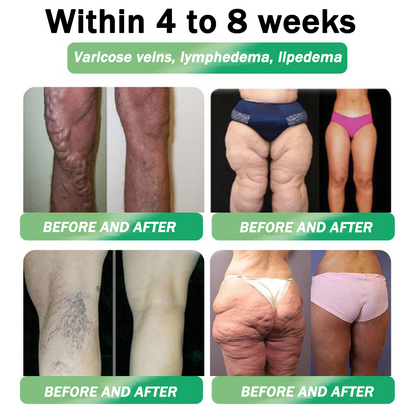 🇺🇸𝑶𝒇𝒇𝒊𝒄𝒊𝒂𝒍 𝑺𝒕𝒐𝒓𝒆|👨‍⚕️👨‍⚕️HH𝐕𝐁® 𝐍𝐀𝐃+ 𝐆𝐋𝐏-𝟏 Pro ALL-IN-ONE Fit&Vital 𝐎𝐫𝐚𝐥 𝐋𝐢𝐪𝐮𝐢𝐝 (𝐉𝐮𝐬𝐭 𝐨𝐧𝐜𝐞 𝐚 𝐝𝐚𝐲, 𝐯𝐢𝐬𝐢𝐛𝐥𝐞 𝐜𝐡𝐚𝐧𝐠𝐞𝐬 𝐢𝐧 𝟕 𝐝𝐚𝐲𝐬） ✅ 𝐅𝐨𝐫 𝐨𝐛𝐞𝐬𝐢𝐭𝐲, 𝐜𝐚𝐫𝐝𝐢𝐨𝐯𝐚𝐬𝐜𝐮𝐥𝐚𝐫 𝐡𝐞𝐚𝐥𝐭𝐡, 𝐝𝐢𝐚𝐛𝐞𝐭𝐞𝐬, 𝐬𝐥𝐞𝐞𝐩 𝐚𝐩𝐧𝐞𝐚, 𝐆𝐮𝐭 𝐇𝐞𝐚𝐥𝐭𝐡, 𝐣𝐨𝐢𝐧𝐭 𝐢𝐬𝐬𝐮𝐞𝐬, 𝐚𝐧𝐝 𝐦𝐨𝐫𝐞