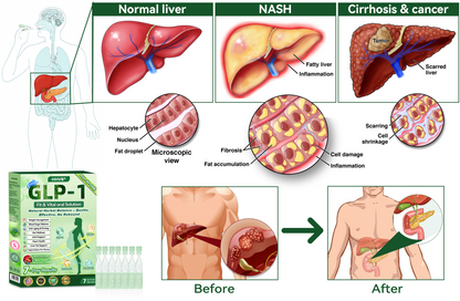 🇺🇸𝑶𝒇𝒇𝒊𝒄𝒊𝒂𝒍 𝑺𝒕𝒐𝒓𝒆|👨‍⚕️👨‍⚕️HH𝐕𝐁® 𝐍𝐀𝐃+ 𝐆𝐋𝐏-𝟏 Pro ALL-IN-ONE Fit&Vital 𝐎𝐫𝐚𝐥 𝐋𝐢𝐪𝐮𝐢𝐝 (𝐉𝐮𝐬𝐭 𝐨𝐧𝐜𝐞 𝐚 𝐝𝐚𝐲, 𝐯𝐢𝐬𝐢𝐛𝐥𝐞 𝐜𝐡𝐚𝐧𝐠𝐞𝐬 𝐢𝐧 𝟕 𝐝𝐚𝐲𝐬） ✅ 𝐅𝐨𝐫 𝐨𝐛𝐞𝐬𝐢𝐭𝐲, 𝐜𝐚𝐫𝐝𝐢𝐨𝐯𝐚𝐬𝐜𝐮𝐥𝐚𝐫 𝐡𝐞𝐚𝐥𝐭𝐡, 𝐝𝐢𝐚𝐛𝐞𝐭𝐞𝐬, 𝐬𝐥𝐞𝐞𝐩 𝐚𝐩𝐧𝐞𝐚, 𝐆𝐮𝐭 𝐇𝐞𝐚𝐥𝐭𝐡, 𝐣𝐨𝐢𝐧𝐭 𝐢𝐬𝐬𝐮𝐞𝐬, 𝐚𝐧𝐝 𝐦𝐨𝐫𝐞